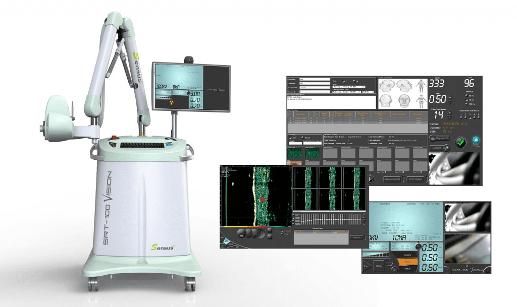 Image-Guided SRT machine
