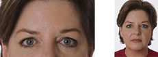 woman's eyes