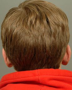 back of a person's ears