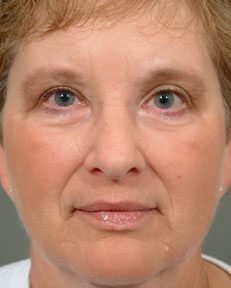 full view of a woman's facial features