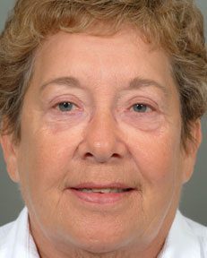 a woman with wrinkles smiling