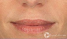 a woman's lips smiling