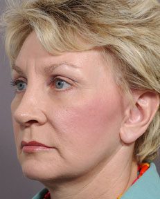 left side profile of a woman