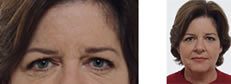 woman's eye with wrinkles