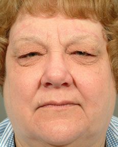full face image of a woman