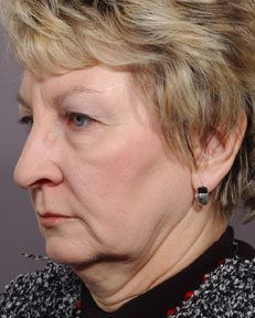 left side a woman's facial features