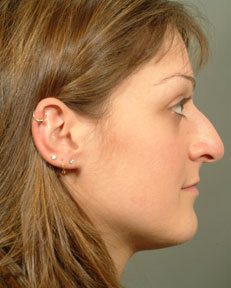 facial profile