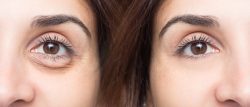 two women's eyes