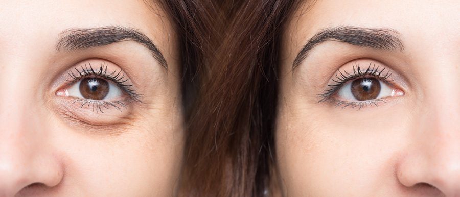 two women's eyes