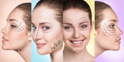 Image of possible facelift options