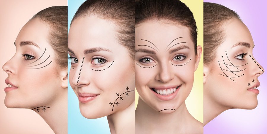 Image of possible facelift options