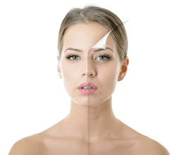 woman with beautiful skin