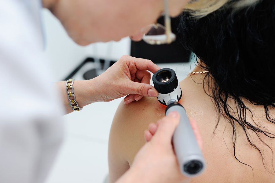 female doctor examining mole on patients back