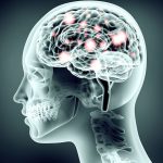 X-ray of person and brain