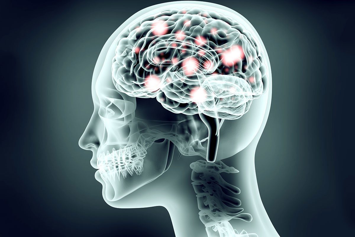 X-ray of person and brain
