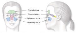 sinusitis anatomy